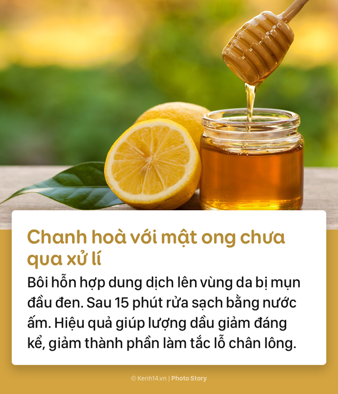 Học ngay những c&aacute;ch sau để xo&aacute; đi mụn đầu đen xấu x&iacute; lấm tấm tr&ecirc;n gương mặt - Ảnh 9.