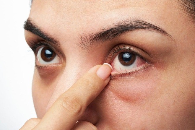 Ngày càng nhiều người bị co giật mí mắt - đó là dấu hiệu nghiêm trọng? Hãy để khoa học giải đáp cho bạn - Ảnh 3.