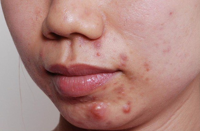 5 dấu hiệu cảnh b&aacute;o bạn đang bị mất c&acirc;n bằng dinh dưỡng - Ảnh 3.