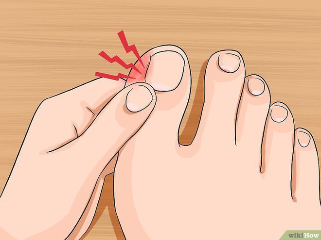 Để giữ sức khỏe tốt, hãy chăm sóc móng chân một cách đúng đắn và thường xuyên. Móng chân thâm đen có thể là dấu hiệu cho thấy sức khỏe của bạn đang bị ảnh hưởng bởi một số bệnh tật, vì vậy hãy chú ý để phát hiện và điều trị kịp thời!