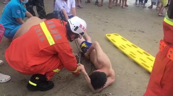 Đau đớn tột cùng: Đang bơi ngoài biển, thanh niên bất ngờ bị cá đuối chích vào vùng kín - Ảnh 3.