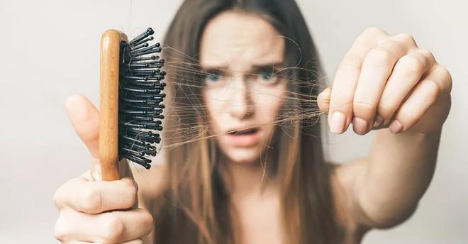 5 dấu hiệu kh&aacute;c thường ở m&aacute;i t&oacute;c đang ngầm cảnh b&aacute;o một loạt vấn đề sức khỏe xảy ra trong cơ thể bạn - Ảnh 1.