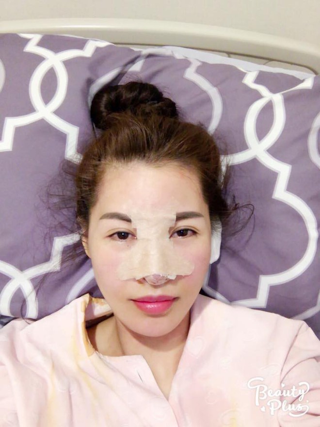 Nhan sắc hiện tại của những sao Việt c&ocirc;ng khai &ldquo;đập đi x&acirc;y lại&rdquo;: Người được khen ngợi, người g&acirc;y sốc v&igrave; gương mặt biến dạng - Ảnh 1.