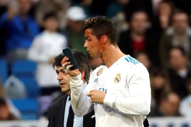 Ronaldo lập cú đúp, chảy máu ướt mặt trong chiến thắng 7-1 của Real Madrid - Ảnh 11.