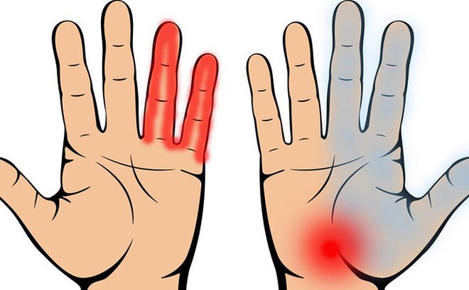 8 dấu hiệu sớm và triệu chứng ung thư phổi - Ảnh 7.