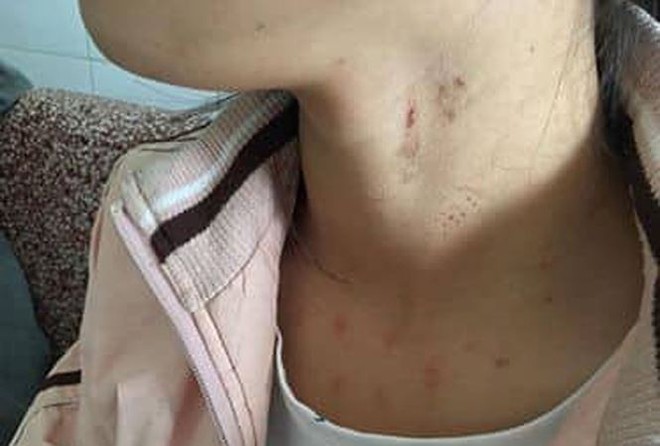 Người phụ nữ tr&igrave;nh b&aacute;o con g&aacute;i học lớp 10 bị kẻ lạ mặt cưỡng bức - Ảnh 1.
