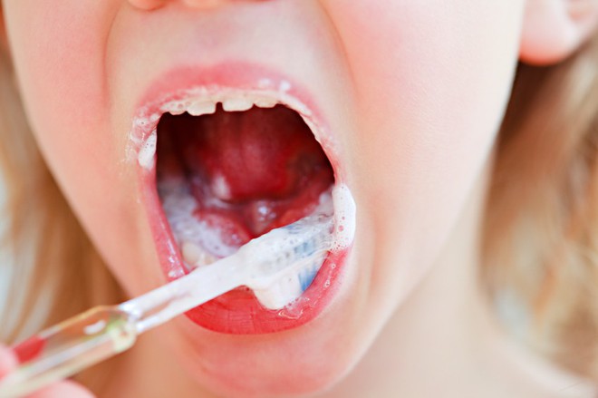 Không muốn bị sâu răng từ sớm thì nên hình thành dần 7 thói quen lành mạnh sau - Ảnh 5.
