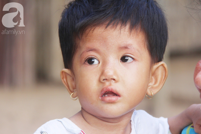 Lời khẩn cầu của người mẹ &ocirc;m con g&aacute;i 2 tuổi bị hở van tim, chỉ nặng 6 k&yacute; m&agrave; kh&ocirc;ng c&oacute; tiền chạy chữa - Ảnh 18.