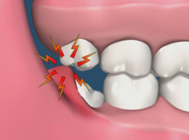 5 dấu hiệu bất thường ở vùng răng miệng có thể dự báo nhiều căn bệnh nguy hiểm mà bạn không lường trước được - Ảnh 1.