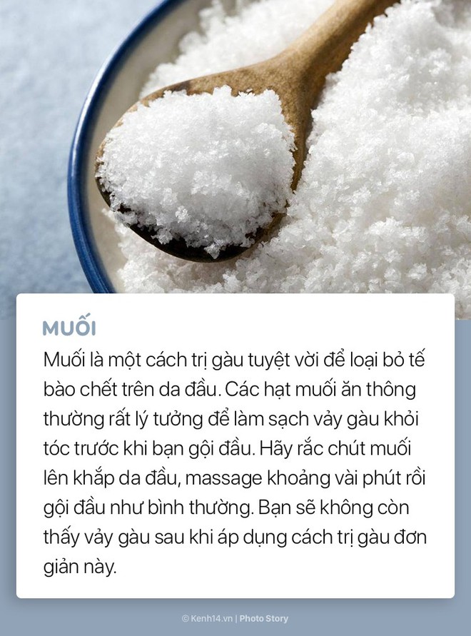 Nếu trị gàu không hiệu quả với dầu gội hãy thử ngay với 5 mẹo này - Ảnh 7.