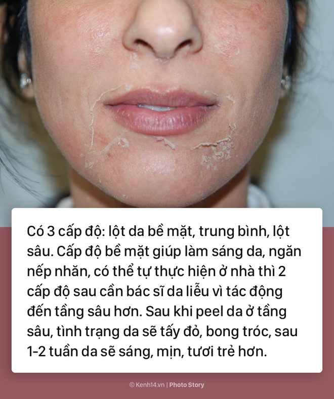 Đ&aacute;nh bay nếp nhăn tuổi t&aacute;c ngay với những liệu ph&aacute;p chăm s&oacute;c da n&agrave;y - Ảnh 5.
