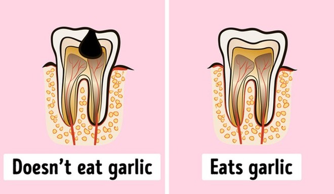 Lợi ích của việc ăn tỏi mỗi ngày - Ảnh 7.