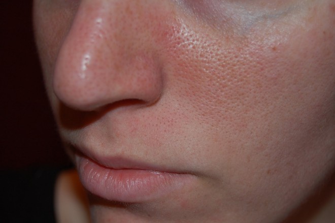 4 biểu hiện cho thấy làn da của bạn đang lão hóa sớm vì chăm sóc da sai cách - Ảnh 3.