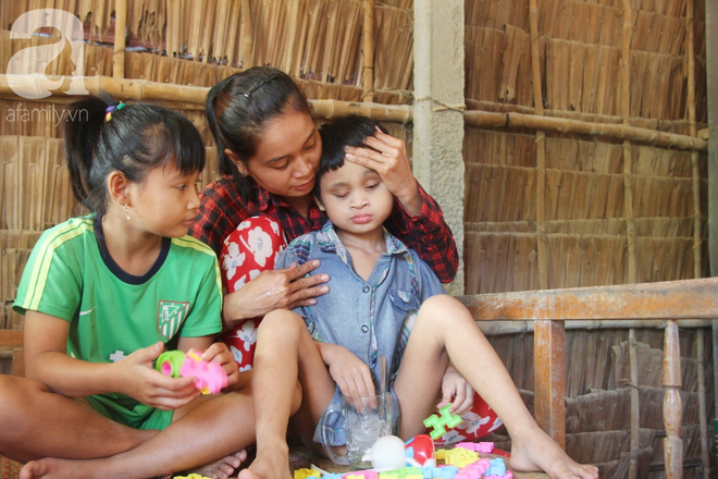 Bố bị chấn thương sọ n&atilde;o, con trai m&ugrave; 6 tuổi gục đầu l&ecirc;n vai mẹ, &uacute; ớ lấy l&aacute; dừa hốt c&aacute;t để ăn - Ảnh 12.