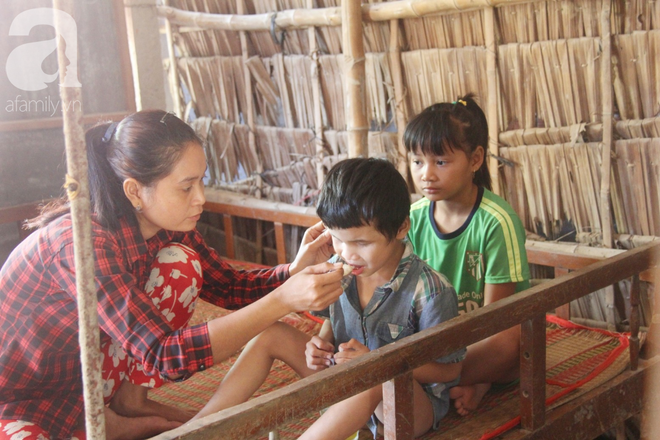 Bố bị chấn thương sọ n&atilde;o, con trai m&ugrave; 6 tuổi gục đầu l&ecirc;n vai mẹ, &uacute; ớ lấy l&aacute; dừa hốt c&aacute;t để ăn - Ảnh 8.