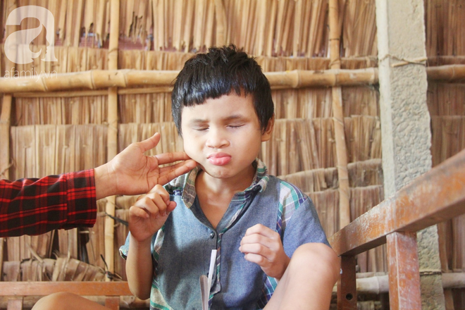 Bố bị chấn thương sọ n&atilde;o, con trai m&ugrave; 6 tuổi gục đầu l&ecirc;n vai mẹ, &uacute; ớ lấy l&aacute; dừa hốt c&aacute;t để ăn - Ảnh 10.
