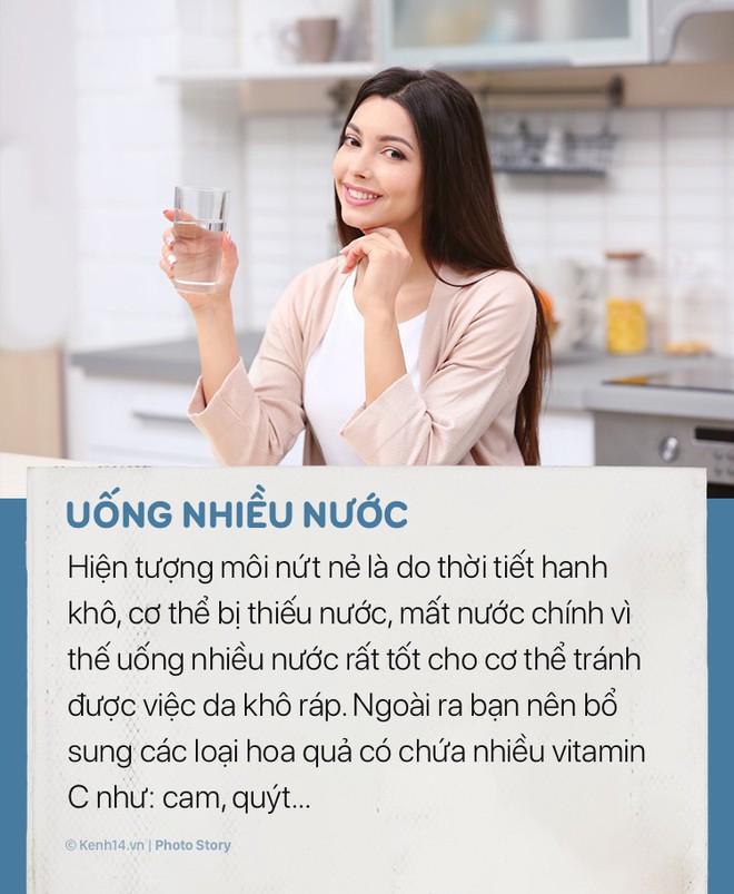 Đôi môi không còn nứt nẻ, thô ráp khó chịu vào mùa đông nhờ những mẹo đơn giản này - Ảnh 1.