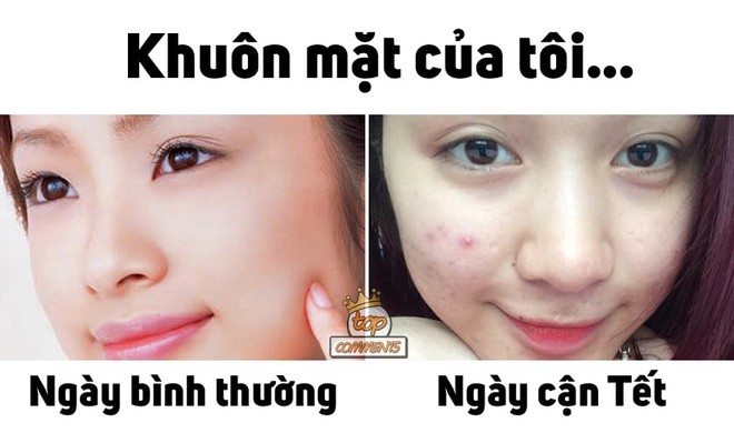 Có 1 kiểu người bình thường da luôn láng mịn nhưng cứ cận Tết là mụn lại rủ nhau về  - Ảnh 1.