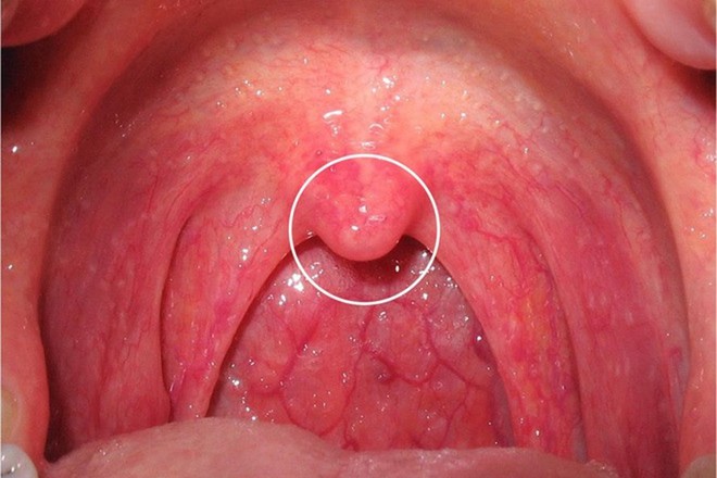 Nước bọt tiết nhiều ở khoang miệng là triệu chứng cảnh báo một vài vấn đề sức khỏe mà bạn không nên xem thường - Ảnh 5.