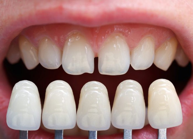 5 triệu chứng bất thường ở răng miệng cảnh báo nhiều vấn đề nguy hại mà bạn không nên chủ quan bỏ qua - Ảnh 2.