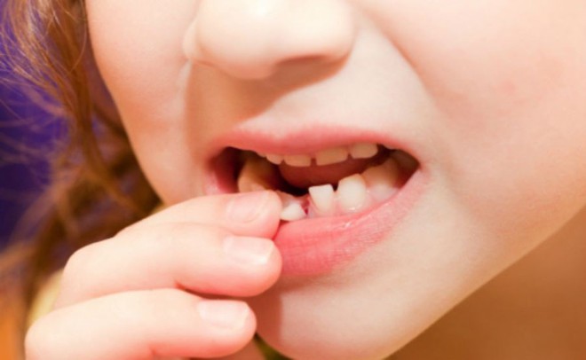 5 triệu chứng bất thường ở răng miệng cảnh báo nhiều vấn đề nguy hại mà bạn không nên chủ quan bỏ qua - Ảnh 5.