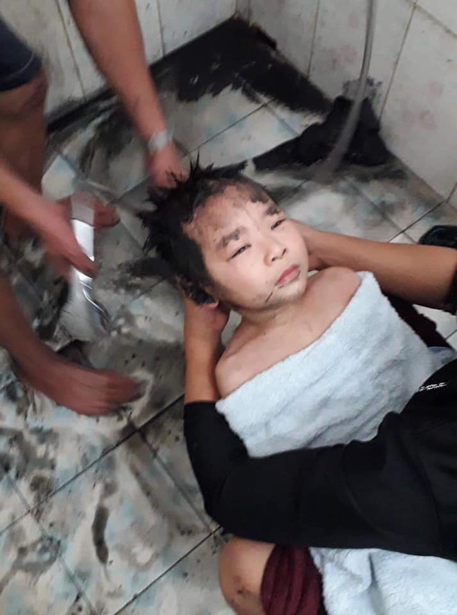 Giải cứu th&agrave;nh c&ocirc;ng phi vụ đi t&egrave; thế kỷ: Cậu b&eacute; đi vệ sinh đ&ecirc;m bị ng&atilde; v&agrave;o b&ugrave;n gieo mạ, to&agrave;n th&acirc;n đen s&igrave; kh&ocirc;ng hở một chỗ trống - Ảnh 4.