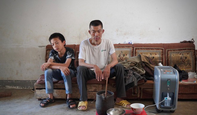 Những cái chết ám ảnh vì bụi phổi ở làng góa phụ - Ảnh 4.