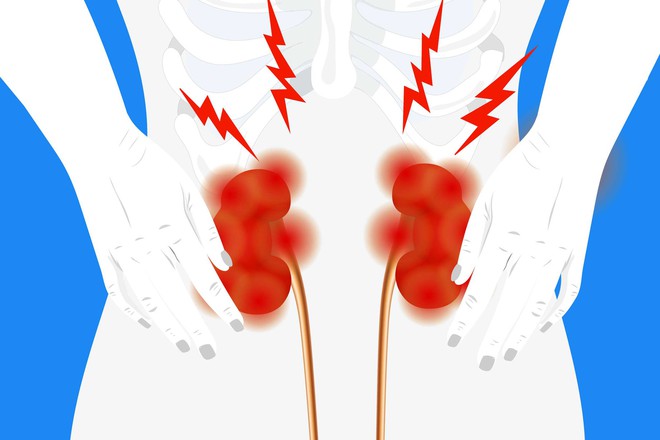 Mẹ hiến thận cho con gái bị suy thận mạn tính do chủ quan, xem thường sức khỏe - Ảnh 2.