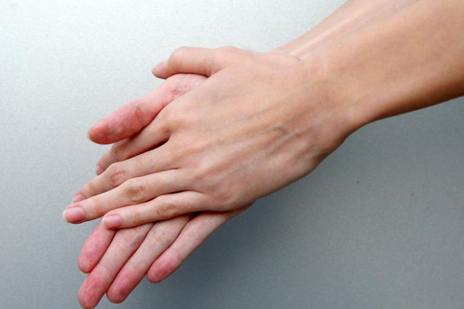 10 dấu hiệu của móng tay cho thấy sức khỏe của bạn đang có vấn đề - Ảnh 1.