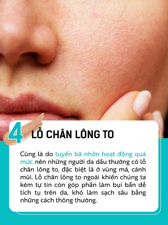 Da dầu vui thì ít, khổ thì nhiều và đây là top 5 điều nhức nhối nhất - Ảnh 5.