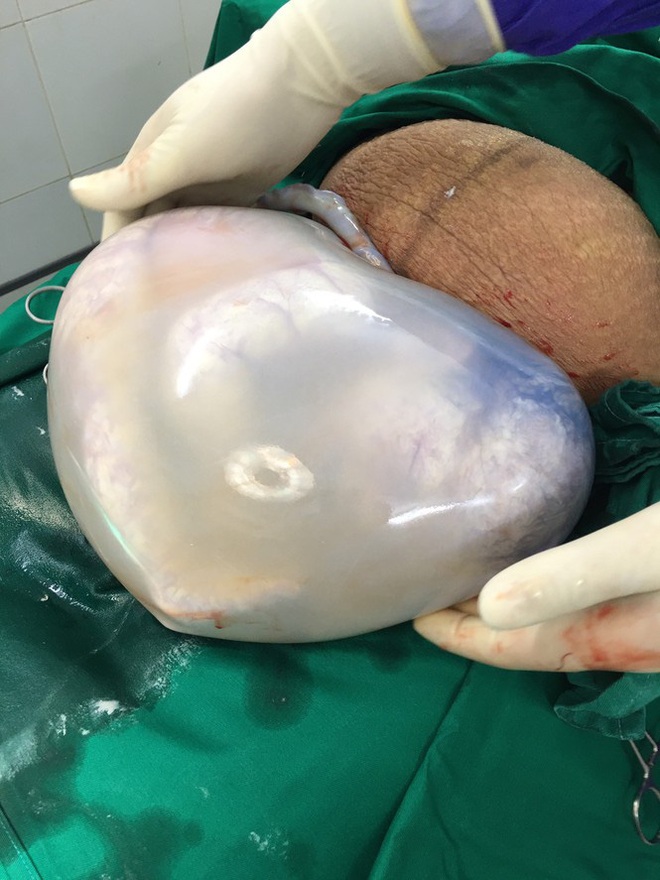 Kỳ lạ hai bé song sinh nằm gọn trong bọc ối hình trái tim - Ảnh 3.