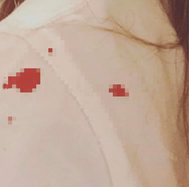 Tin sốc giữa đêm: HyunA đăng ảnh đầy máu me, có chuyện gì đang xảy ra? - Ảnh 4.