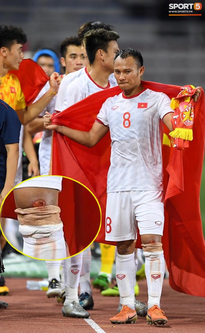 Góc chạnh lòng: Trọng Hoàng đứng một mình buồn thiu với đầu gối chảy máu khi cả đội đang ăn mừng vô địch SEA Games - Ảnh 1.