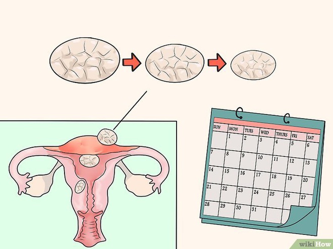 Chủ quan trong việc bổ sung estrogen, nữ giới sẽ phải đối mặt với một số bộ phận bị teo tóp theo thời gian - Ảnh 1.