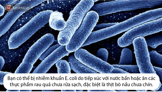 Ăn salad và rau sống, hàng trăm người bị nhiễm khuẩn E. coli - Ảnh 3.