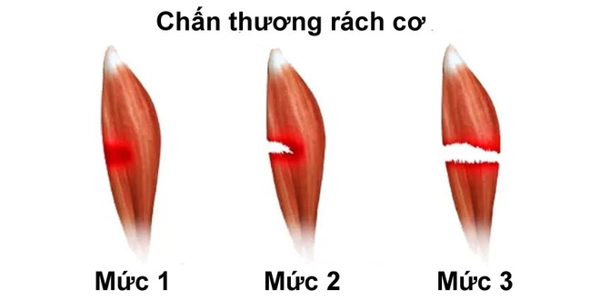 chan-thuong-rach-co-huy-toan