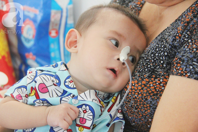 Ánh mắt cầu cứu của bé trai 7 tháng tuổi bị mẹ bỏ rơi trước cổng chùa vì mắc bệnh bại não - Ảnh 5.