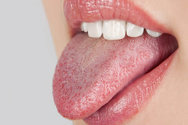 Giải m&atilde; t&igrave;nh trạng đ&atilde; uống đủ nước m&agrave; cơ thể vẫn cảm thấy kh&aacute;t - Ảnh 3.