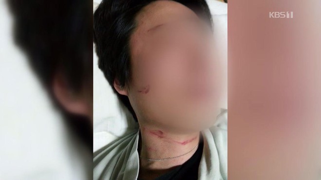 Ái nữ tai tiếng của chủ tịch Korean Air bị chồng kiện bạo hành gia đình, tung bằng chứng thương tích gây dậy sóng dư luận - Ảnh 4.