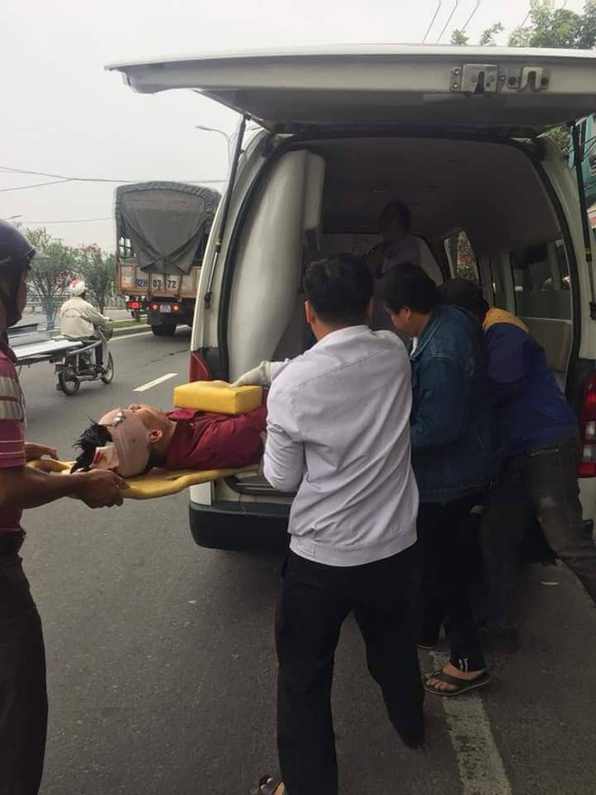 Dừng xe máy nghe điện thoại, nam thanh niên ở Đà Nẵng bị ô tô tông văng lên vỉa hè, chấn thương sọ não - Ảnh 2.