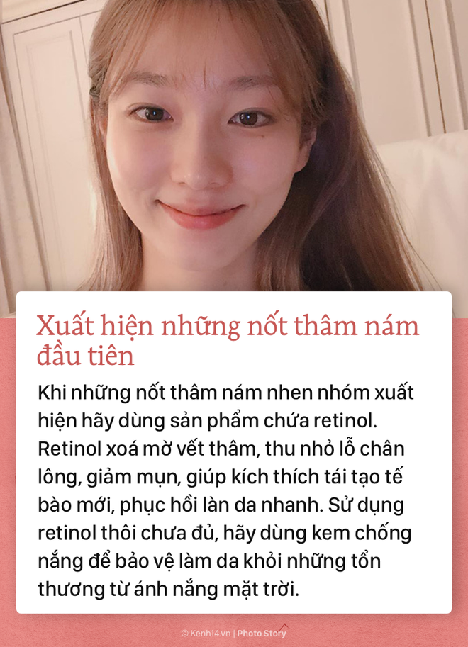 Th&acirc;m n&aacute;m l&agrave; dấu hiệu l&atilde;o h&oacute;a da - Ảnh 3.
