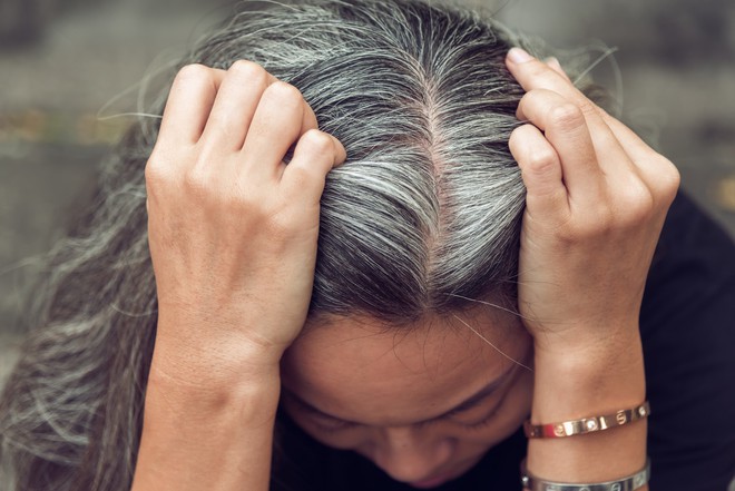 Một vài dấu hiệu khác thường ở mái tóc đang ngầm báo hiệu nhiều vấn đề sức khỏe tiềm ẩn - Ảnh 4.