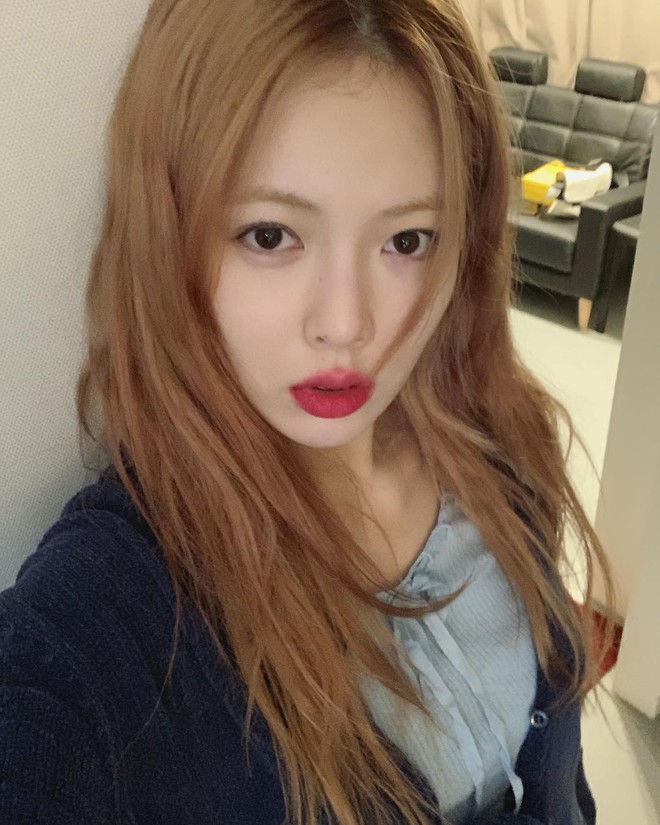 Hyuna khoe ảnh chụp đầu gối đầy những vết thâm tím, netizen lại được dịp suy diễn đủ điều - Ảnh 2.