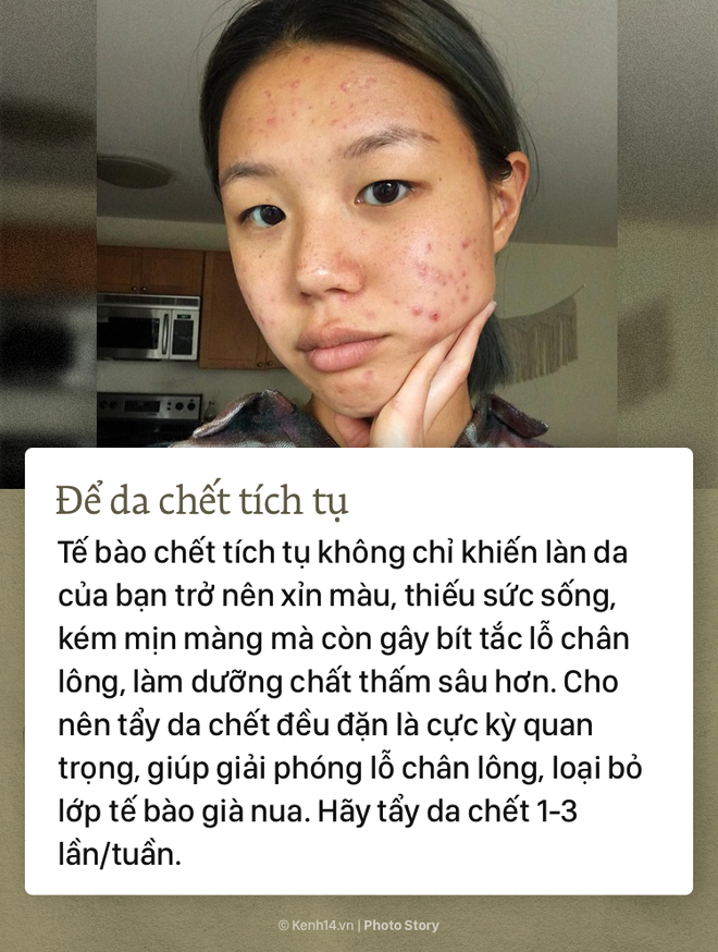 Những sai lầm nghiêm trọng này sẽ làm cho bạn dù cố gắng skincare cỡ nào cũng bằng thừa - Ảnh 5.