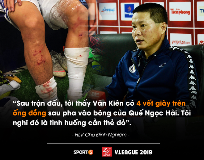 HLV Hà Nội FC: Quế Ngọc Hải xứng đáng nhận thẻ đỏ với 4 vết giày đinh hằn trên ống đồng Văn Kiên - Ảnh 1. HLV Hà Nội FC: Quế Ngọc Hải xứng đáng nhận thẻ đỏ với 4 vết giày đinh hằn trên ống đồng Văn Kiên - Ảnh 1.