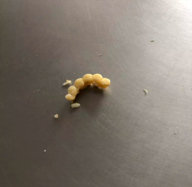 Đang ăn cơm ngon lành ở căng tin, nữ sinh Trung Quốc phát hiện trong bát mình có một đoạn... răng giả! - Ảnh 4.