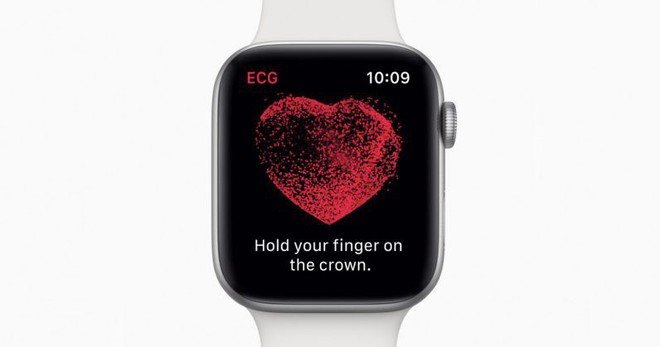Đột quỵ đến mức suýt về chầu, thanh niên hú hồn không tin mình được cứu sống bởi Apple Watch - Ảnh 3.