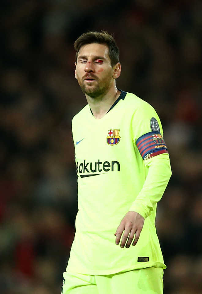 Messi chảy máu đầm đìa sau khi bị trung vệ MU gạt tay trúng mặt - Ảnh 6.