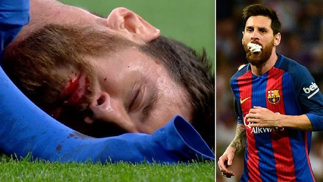 Messi chảy máu đầm đìa sau khi bị trung vệ MU gạt tay trúng mặt - Ảnh 7.