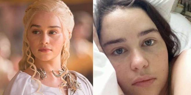 Màn hồi phục kì diệu sau 2 ca mổ não phức tạp của Mẹ Rồng Emilia Clarke - Ảnh 2.